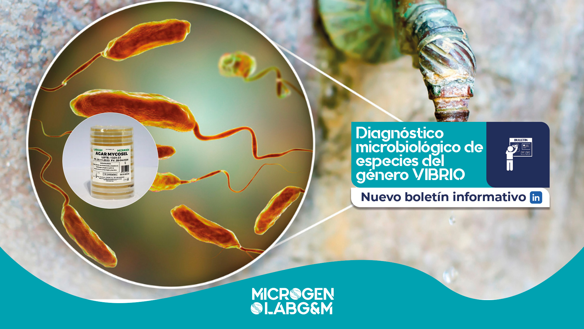Diagnóstico microbiológico de especies del género vibrio