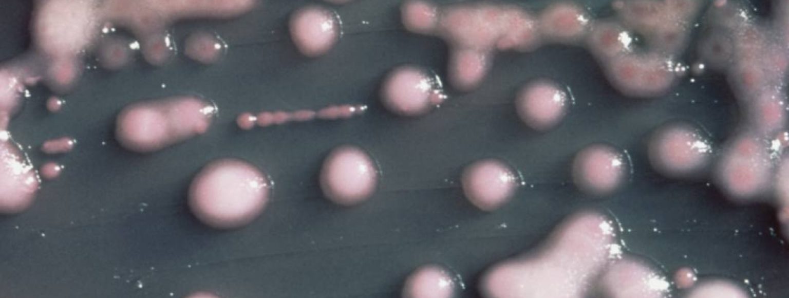 Klebsiella pneumoniae