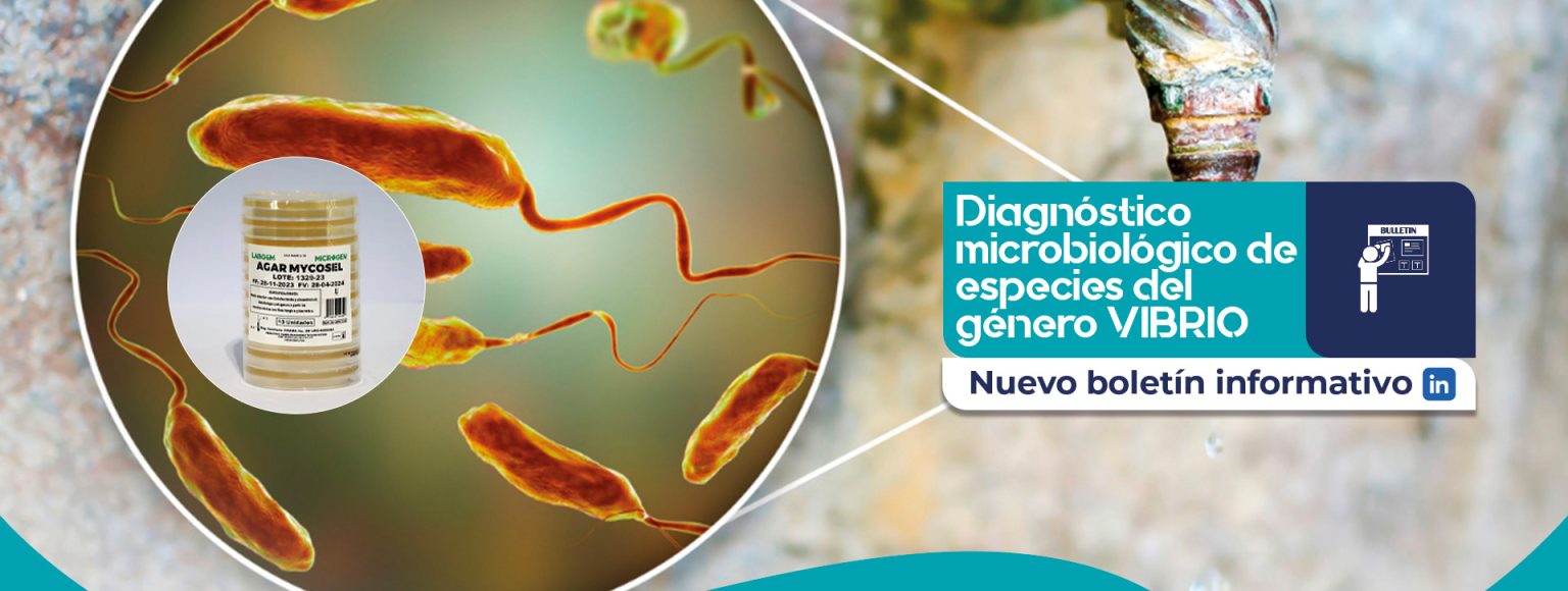 Diagnóstico microbiológico de especies del género vibrio